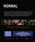Normal (MOD) (BluRay Movie) - back cover art