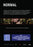 Normal (MOD) (DVD Movie) - back cover art