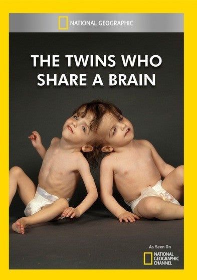 The Twins Who Share A Brain (MOD) (DVD Movie)